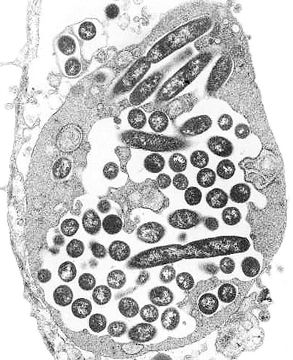 Legionella pneumophila - (eine der ersten Aufnahme von sich vermehrenden Bakterien in einem menschlichen Lungenfibroblast) - hat bei 37°C Körpertemperatur optimale Bedingungen zur intrazellulären Vermehrung. Zu sehen sind Legionellen während der Zellteilung, im Quer-und Längsschnitt. Elektronenmikroskop-Aufnahme von Dr.Edwin P. Ewing Jr. CDC, 1979.